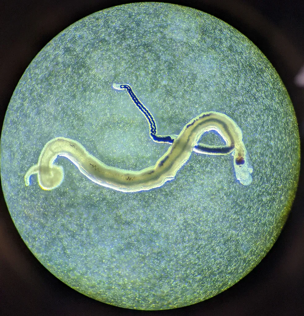 A schistosome worm pair photographed through a microscope.